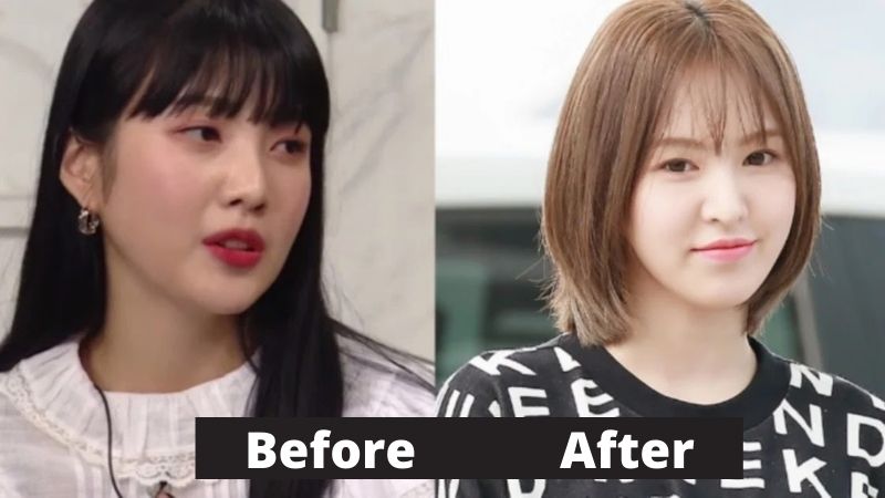 Red Velvet Wendy Weight Loss