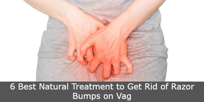 How to get gid of razor bump on vag
