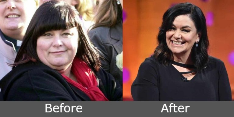 Dawn French Weight Loss