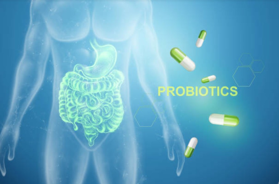 How to choose a probiotic supplement?
