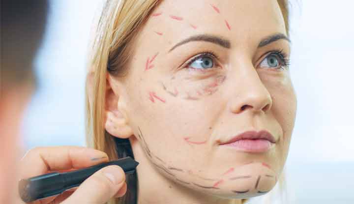 When does Facial Sagging Happen following a Facelift?