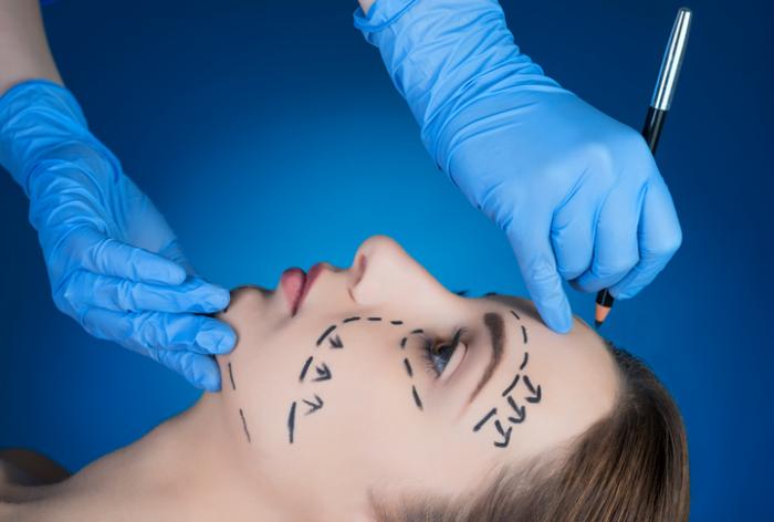 What to Expect During Your Facelift Consultation