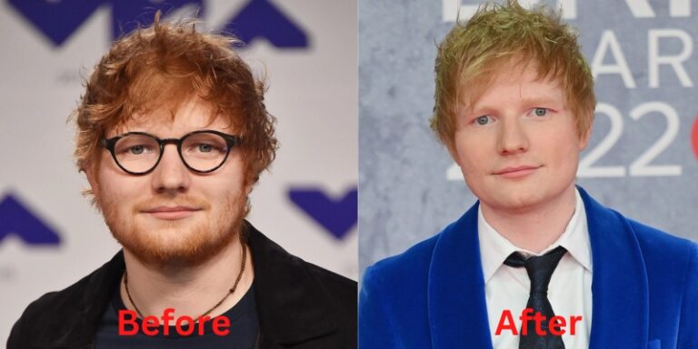Ed Sheeran Weight Loss