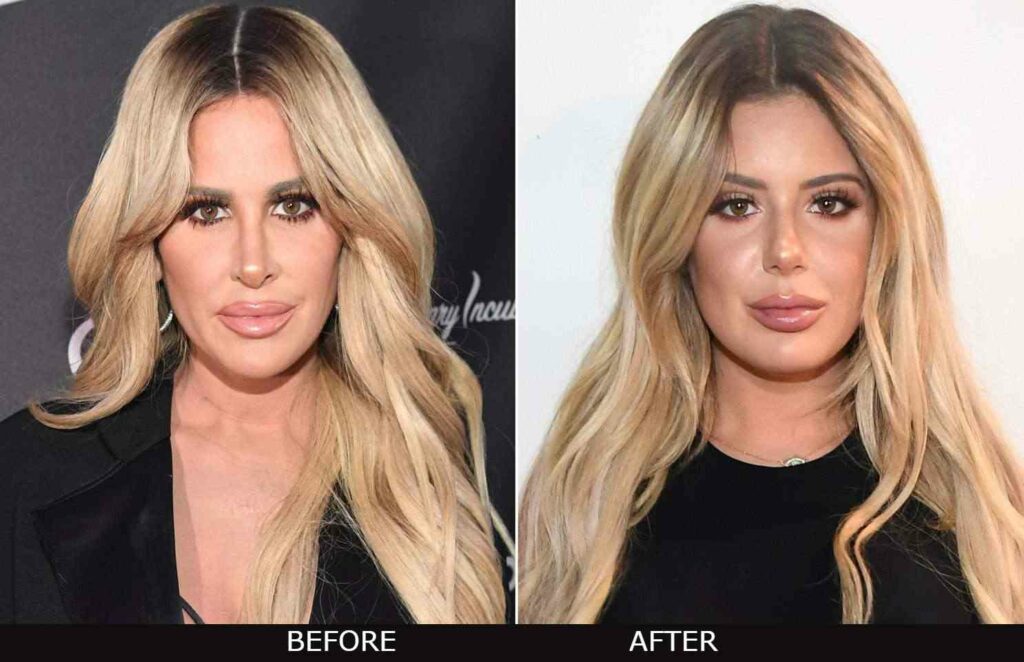 Ariana Biermann examines before and after