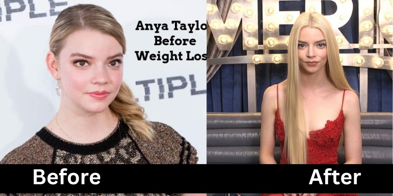 Anya Taylor Joy Weight Loss