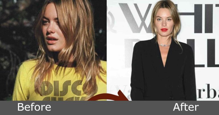 Camille Rowe's weight loss